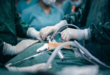 thyroidectomy surgery related searches